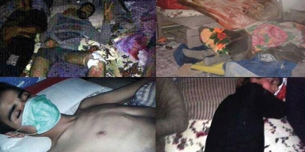 Sarıyıldız 30a yakın kişi yanmış halde bulundu
